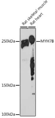 Western Blot: MYH7B Antibody (7W8J3) [NBP3-16495] - Western blot analysis of extracts of various cell lines, using MYH7B antibody (NBP3-16495) at 1:1000 dilution. Secondary antibody: HRP Goat Anti-Rabbit IgG (H+L) at 1:10000 dilution. Lysates/proteins: 25ug per lane. Blocking buffer: 3% nonfat dry milk in TBST. Detection: ECL Basic Kit. Exposure time: 180s.