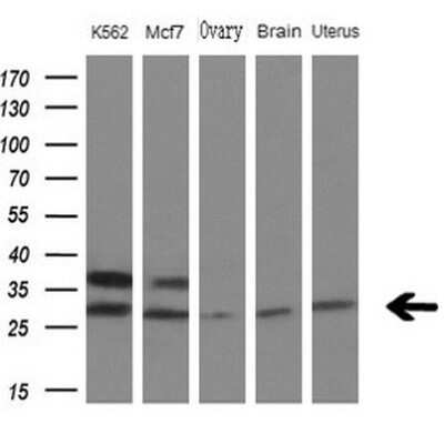 Western Blot: MYL4 Antibody (OTI1H6) - Azide and BSA Free [NBP2-72856] - Analysis of extracts (10ug) from 3 different cell lines and 2 human tissues.