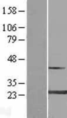 Western Blot: MYL4 Overexpression Lysate (Adult Normal) [NBP2-08944] Left-Empty vector transfected control cell lysate (HEK293 cell lysate); Right -Over-expression Lysate for MYL4.