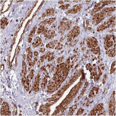 Immunohistochemistry: MYL6 Antibody [NBP2-30441] - Staining of human smooth muscle shows strong positivity in smooth muscle cells.