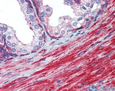 Immunohistochemistry: MYL6 Antibody [NBP3-09356] - Immunohistochemical analysis of human prostate.