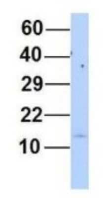 Western Blot: MYL6 Antibody [NBP1-54376] - Human 721_B, Antibody Dilution: 1.0 ug/ml MYL6 is supported by BioGPS gene expression data to be expressed in 721_B.