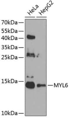 Western Blot: MYL6 Antibody [NBP2-94755] - Analysis of extracts of various cell lines, using MYL6 .Exposure time: 60s.