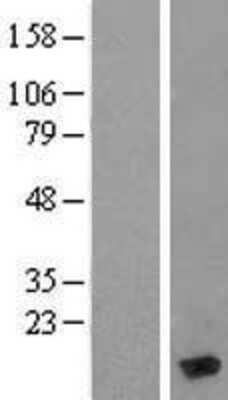 Western Blot: MYL6 Overexpression Lysate (Adult Normal) [NBL1-13427] Left-Empty vector transfected control cell lysate (HEK293 cell lysate); Right -Over-expression Lysate for MYL6.