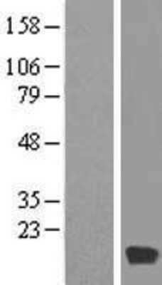 Western Blot: MYL6 Overexpression Lysate (Adult Normal) [NBP2-05791] Left-Empty vector transfected control cell lysate (HEK293 cell lysate); Right -Over-expression Lysate for MYL6.