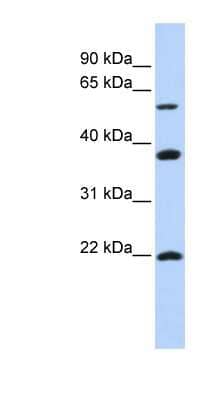 Western Blot: MYLIP Antibody [NBP1-54903] - Titration: 0.2-1 ug/ml, Positive Control: SK-MEL-2 cell lysate.