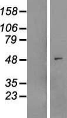 Western Blot: MYLIP Overexpression Lysate (Adult Normal) [NBL1-13432] Left-Empty vector transfected control cell lysate (HEK293 cell lysate); Right -Over-expression Lysate for MYLIP.