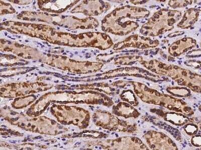 Immunohistochemistry-Paraffin: MYLK4 Antibody [NBP2-98058] - Immunochemical staining of human MYLK4 in human kidney with rabbit polyclonal antibody at 1:100 dilution, formalin-fixed paraffin embedded sections.