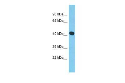 Western Blot: MYLK4 Antibody [NBP2-85343] - Host: Rabbit. Target Name: MYLK4. Sample Type: RPMI-8226 Whole Cell lysates. Antibody Dilution: 1.0ug/ml