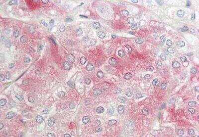 Immunohistochemistry-Paraffin: MYO15A Antibody [NBP2-85110] - Rabbit Anti-MYO15A antibody. Formalin Fixed Paraffin Embedded Tissue: Human Adrenal. Primary antibody Concentration: 1:100. Secondary Antibody: Donkey anti-Rabbit-Cy3. Secondary Antibody Concentration: 1:200. Magnification: 20x. Exposure Time: 0.5-2.0sec