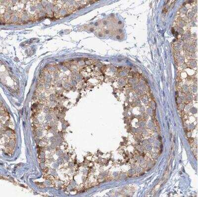 Immunohistochemistry-Paraffin: MYO16 Antibody [NBP1-93617] - Staining of human testis shows moderate cytoplasmic positivity in cells in seminiferous ducts.