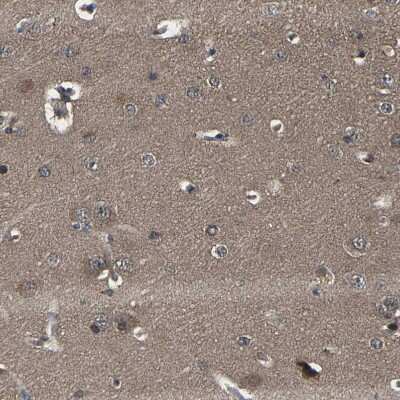 Immunohistochemistry-Paraffin MYO18A Antibody