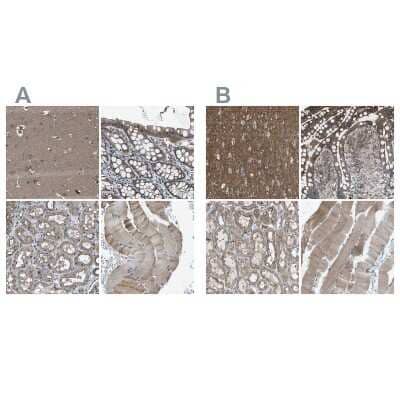 Immunohistochemistry-Paraffin MYO18A Antibody