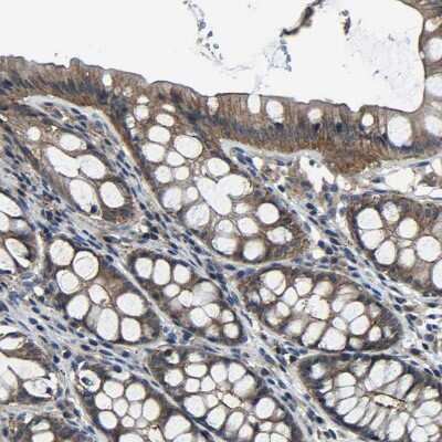 Immunohistochemistry-Paraffin MYO18A Antibody