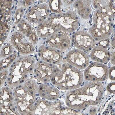 Immunohistochemistry-Paraffin: MYO18A Antibody [NBP1-83020] - Staining of human kidney shows weak to moderate cytoplasmic and membranous positivity in cells in tubules.