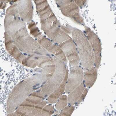 Immunohistochemistry-Paraffin: MYO18A Antibody [NBP1-83020] - Staining of human skeletal muscle shows moderate cytoplasmic positivity in myocytes.