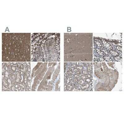 Immunohistochemistry-Paraffin MYO18A Antibody - BSA Free