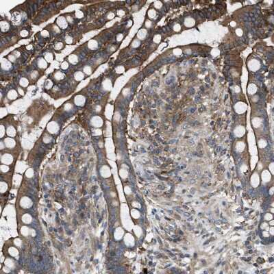 Immunohistochemistry-Paraffin MYO18A Antibody - BSA Free