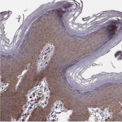 Immunohistochemistry-Paraffin MYO19 Antibody - BSA Free