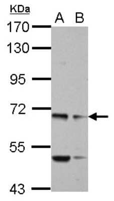 Western Blot: MYO19 Antibody [NBP2-19450] - Sample (30 ug of whole cell lysate) A: U87-MG B: SK-N-SH 7. 5% SDS PAGE gel, diluted at 1:3000.
