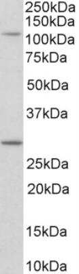 Western Blot: MYO1H Antibody [NBP2-26205] - Staining of NIH3T3 lysate (35 ug protein in RIPA buffer). Primary incubation was 1 hour. Detected by chemiluminescence.