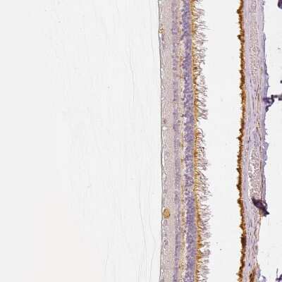 Immunohistochemistry-Paraffin: MYO3A Antibody [NBP2-13636] - Staining of human eye, retina shows moderate positivity in photoreceptor and ganglion cells.