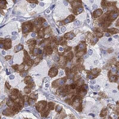 Immunohistochemistry-Paraffin: MYO3A Antibody [NBP3-17742] - Staining of human pituitary gland shows strong cytoplasmic positivity in anterior pituitary.