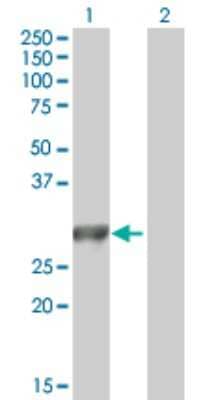 Western Blot: MYO3A Antibody [H00053904-B01P] - Analysis of MYO3A expression in transfected 293T cell line by MYO3A polyclonal antibody.  Lane 1: MYO3A transfected lysate(27.17 KDa). Lane 2: Non-transfected lysate.