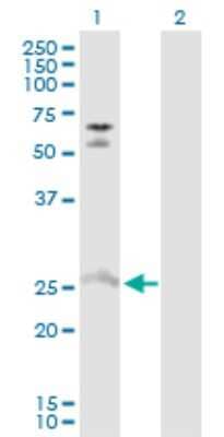 Western Blot: MYO3A Antibody [H00053904-D01P] - Analysis of MYO3A expression in transfected 293T cell line by MYO3A polyclonal antibody.Lane 1: MYO3A transfected lysate(27.60 KDa).Lane 2: Non-transfected lysate.