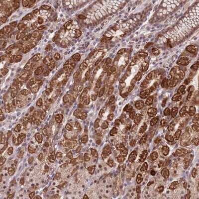 Immunohistochemistry MYO3B Antibody