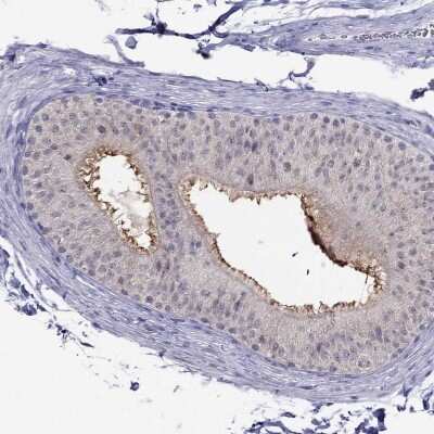 Immunohistochemistry-Paraffin MYO3B Antibody