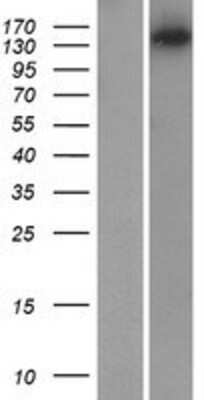 Western Blot MYO3B Overexpression Lysate