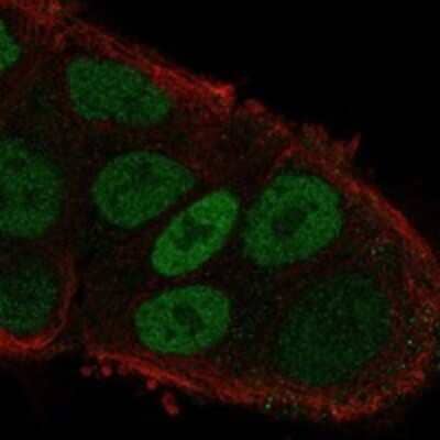 Immunocytochemistry/Immunofluorescence: MYO6 Antibody [NBP3-17276] - Staining of human cell line RT4 shows localization to nucleoplasm.