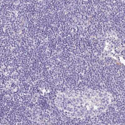 Immunohistochemistry-Paraffin MYO6 Antibody