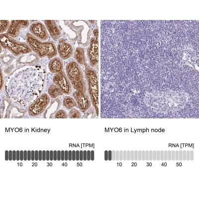 <b>Orthogonal Strategies Validation. </b>Immunohistochemistry-Paraffin: MYO6 Antibody [NBP2-38254] - Staining in human kidney and lymph node tissues using anti-MYO6 antibody. Corresponding MYO6 RNA-seq data are presented for the same tissues.