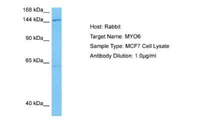 Western Blot: MYO6 Antibody [NBP2-85347] - Host: Rabbit. Target Name: MYO6. Sample Tissue: Human MCF7 Whole Cell lysates. Antibody Dilution: 1ug/ml