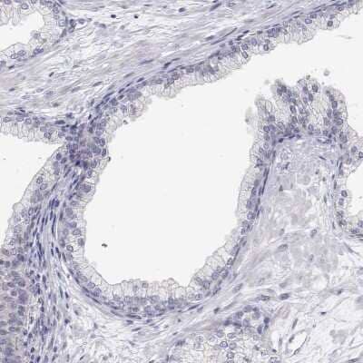 Immunohistochemistry-Paraffin MYPN Antibody