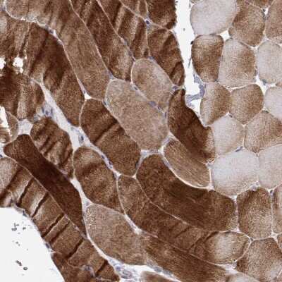 Immunohistochemistry-Paraffin MYPN Antibody