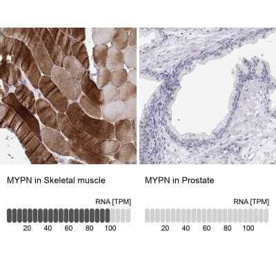 Immunohistochemistry-Paraffin MYPN Antibody