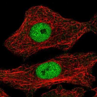 Immunocytochemistry/Immunofluorescence: MYPOP Antibody [NBP2-55767] - Staining of human cell line A549 shows localization to nucleoplasm.