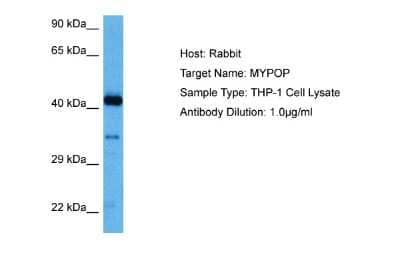 Western Blot: MYPOP Antibody [NBP2-83249] - Host: Rabbit. Target Name: MYPOP. Sample Tissue: Human THP-1 Whole Cell lysates. Antibody Dilution: 1ug/ml