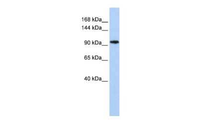 Western Blot: MYRF Antibody [NBP3-10326] - Western blot analysis using NBP3-10326 on Human MCF-7 as a positive control. Antibody Titration: 0.2-1 ug/ml