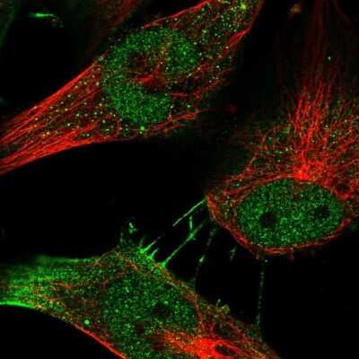 Immunocytochemistry/ Immunofluorescence MYSM1 Antibody