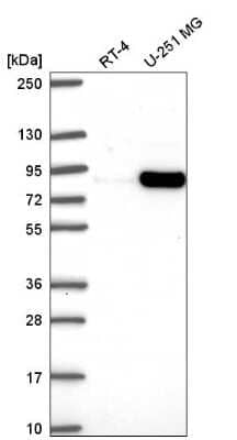 Western Blot MYSM1 Antibody