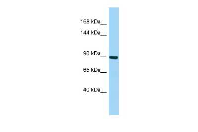 Western Blot: MYSM1 Antibody [NBP2-85353] - Host: Rabbit. Target Name: MYSM1. Sample Type: Fetal Liver lysates. Antibody Dilution: 1.0ug/ml