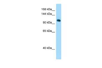 Western Blot: MYSM1 Antibody [NBP2-85354] - Host: Rabbit. Target Name: MYSM1. Sample Type: Hela Whole Cell lysates. Antibody Dilution: 1.0ug/ml