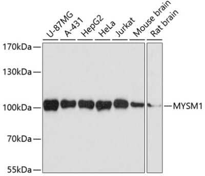 Western Blot: MYSM1 Antibody [NBP2-95199] - Analysis of extracts of various cell lines, using MYSM1 at 1:3000 dilution.Secondary antibody: HRP Goat Anti-Rabbit IgG (H+L) at 1:10000 dilution.Lysates/proteins: 25ug per lane.Blocking buffer: 3% nonfat dry milk in TBST.Detection: ECL Basic Kit .Exposure time: 90s.