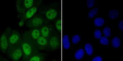 Immunocytochemistry/Immunofluorescence: MYST1 Antibody (JG36-05) [NBP2-76844] - ICC staining KAT8 in MCF-7 cells (green). The nuclear counter stain is DAPI (blue). Cells were fixed in paraformaldehyde, permeabilised with 0.25% Triton X100/PBS.