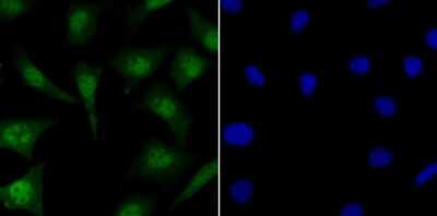 Immunocytochemistry/Immunofluorescence: MYST1 Antibody (JG36-05) [NBP2-76844] - ICC staining KAT8 in SH-SY-5Y cells (green). The nuclear counter stain is DAPI (blue). Cells were fixed in paraformaldehyde, permeabilised with 0.25% Triton X100/PBS.