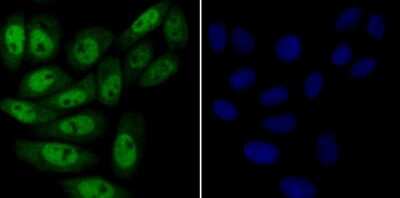 Immunocytochemistry/Immunofluorescence: MYST1 Antibody (JG36-05) [NBP2-76844] - ICC staining KAT8 in SiHa cells (green). The nuclear counter stain is DAPI (blue). Cells were fixed in paraformaldehyde, permeabilised with 0.25% Triton X100/PBS.